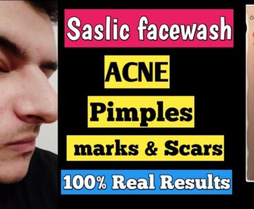 saslic face wash | saslic ds face wash review | salicylic acid facewash | saslic foaming face wash |