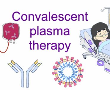 Convalescent plasma therapy in Use against COVID19