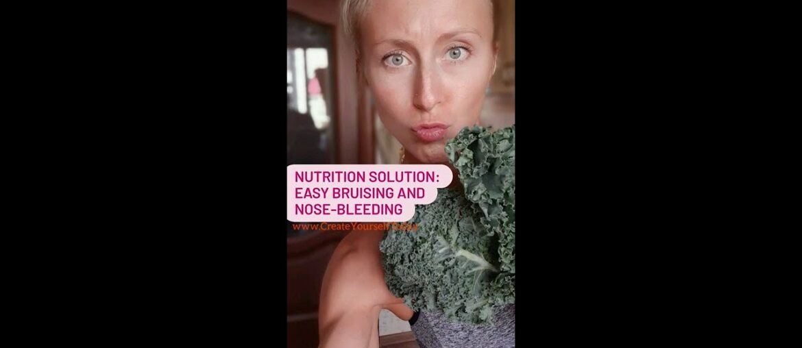 Nutrition solution: how my mom fixed easy bruising eating this food (also fixes nose-bleeding).