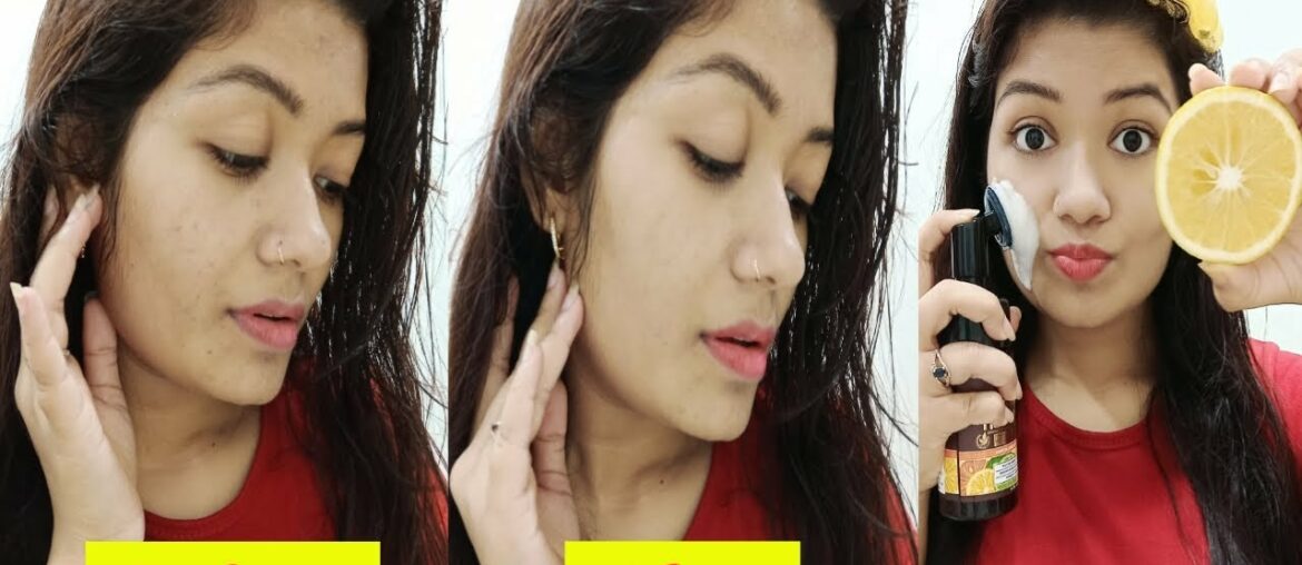 15 Days Challenge With VITAMIN C | For Clear &  Even Tone Skin || Krrish Sarkar