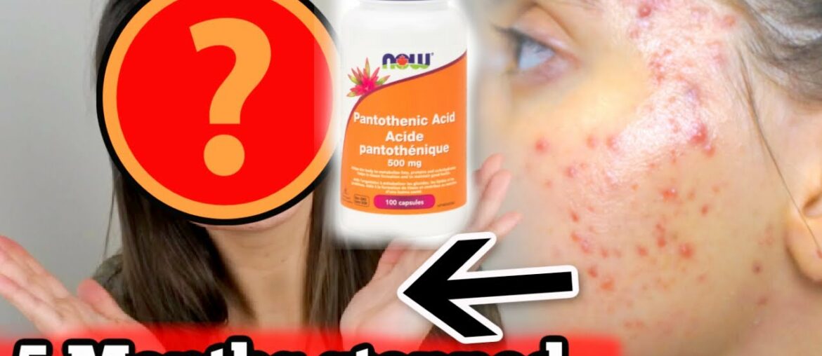 I STOPPED TAKING PANTOTHENIC ACID FOR 5 MONTHS STRAIGHT.. THIS IS WHAT HAPPENED|| Major skin update