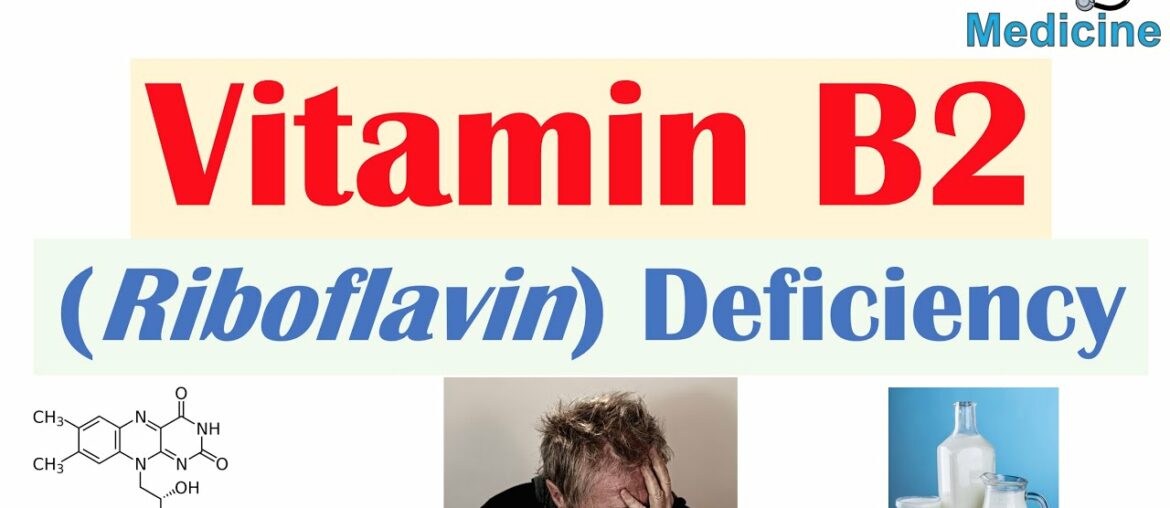 Vitamin B2 (Riboflavin) Deficiency | Food Sources, Causes, Symptoms, Diagnosis and Treatment
