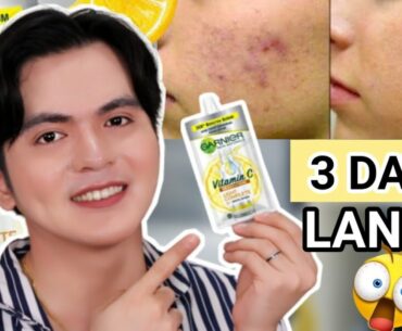 DARK SPOTS TANGGAL IN 3 DAYS?! GARNIER VITAMIN C SERUM REVIEW