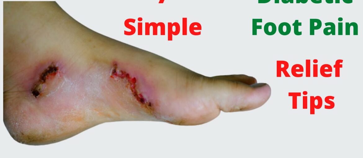 7 Simple Diabetic Foot Pain Relief Tips