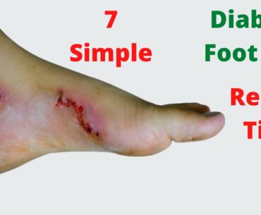 7 Simple Diabetic Foot Pain Relief Tips