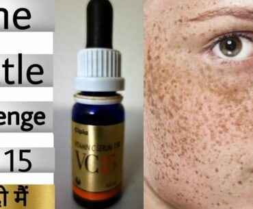 Dr Recommended | VC 15 Vitamin C Serum Review|Best Vitamin C Serum | For hyperpigmentation |Melasma