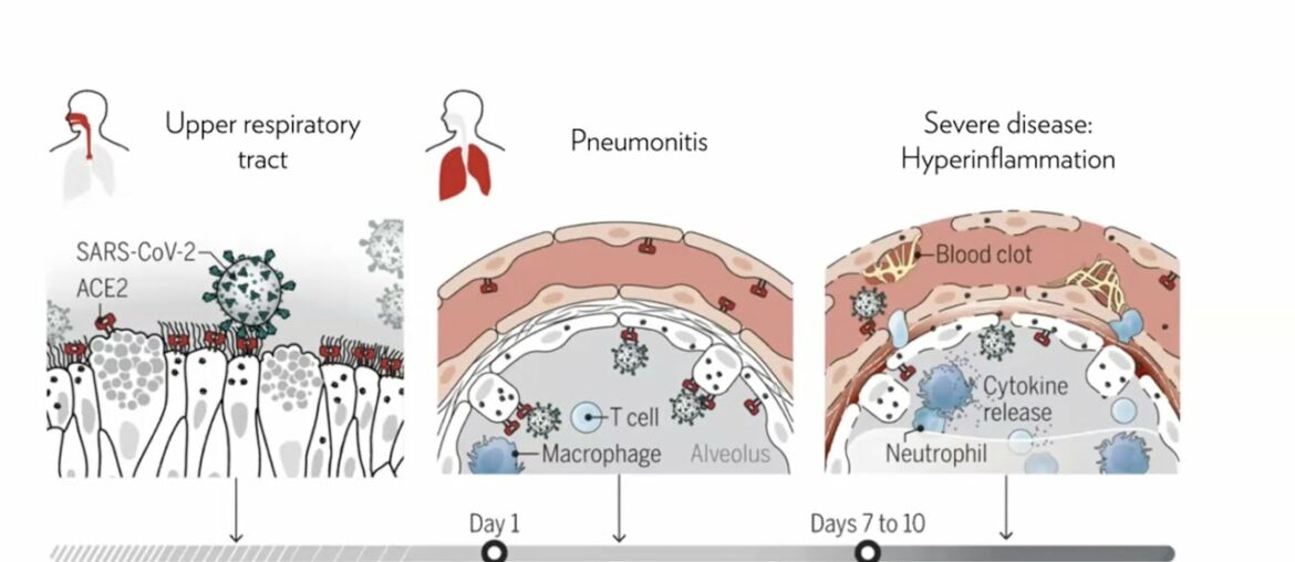 B cell immunity in COVID-19 patients with the aim of identifying antibodies against SARS-CoV-2