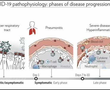 B cell immunity in COVID-19 patients with the aim of identifying antibodies against SARS-CoV-2