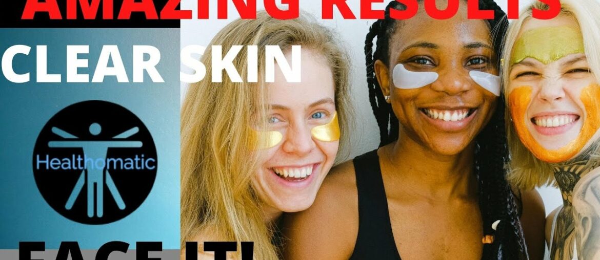 AMAZING CLEAR SKIN & ACNE REMOVAL!