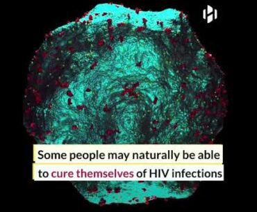 HIV patient recovers fully without drugs thanks to his rare immune response | HIV Infection