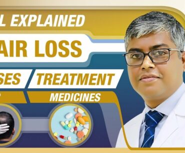 HAIR LOSS - CAUSES & TREATMENT in Hindi |A Complete Guide for HAIR LOSS |LA MIDAS