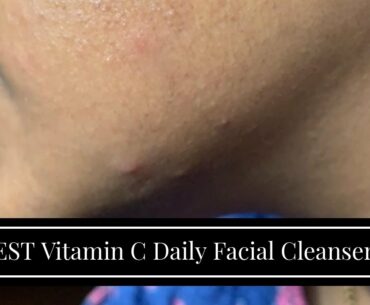 BEST Vitamin C Daily Facial Cleanser - Restorative Anti-Aging Face Wash for All Skin Types with...