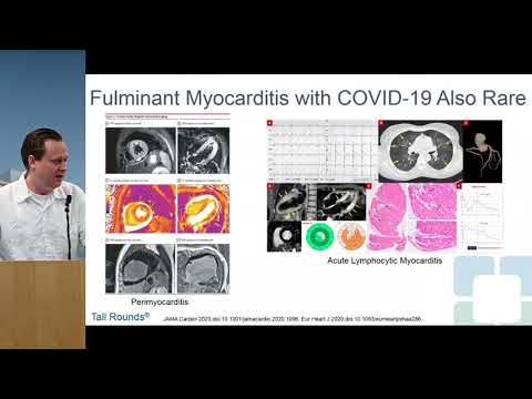 Therapeutics of COVID-19 Induced Myocardial Injury: What we know and what we don't