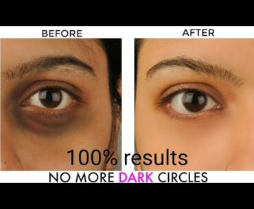 DIY.HOME REMEDY FOR DARK CIRCLE ||THE GIRL'S BEAUTY ICON