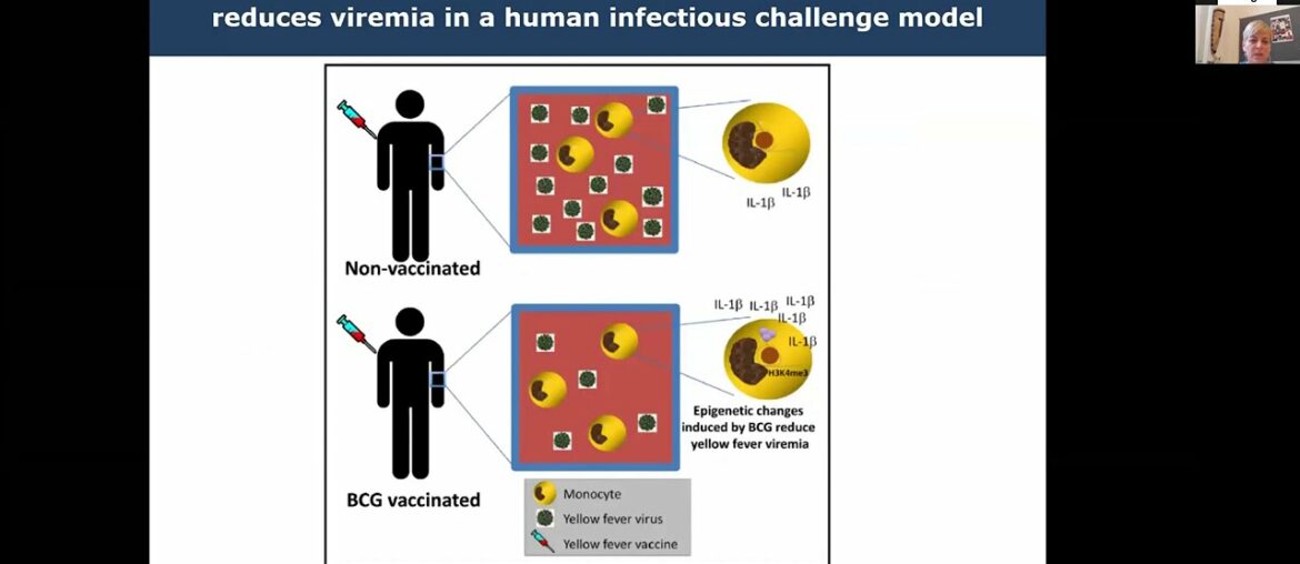 SAIS/Immunopaedia Webinar on BCG & COVID-19