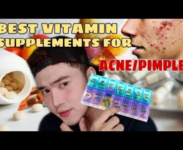 5 VITAMIN SUPPLEMENTS FOR ACNE / PIMPLES (Gamot sa pimples)