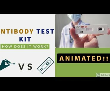 Antibody testing for coronavirus !!!! how is it done??? Benefits and comparison!!! (ANIMATED)