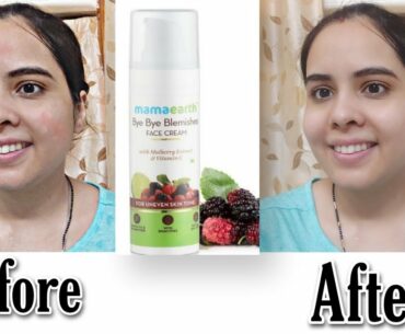 Bye Bye blemishes face cream with Mulberry extract & vitamin c review | face cream