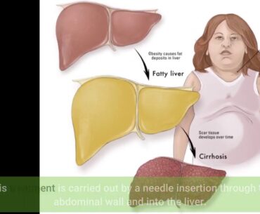 Getting My Vitamin E as an Adjuvant Treatment for Non  - Cureus To Work