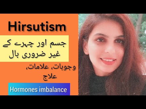 Hirsutism || facial hairs || causes/Treatment || irum Rehman