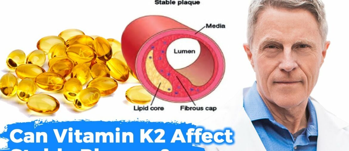 Can Vitamin K2 Affect Stable Plaques?