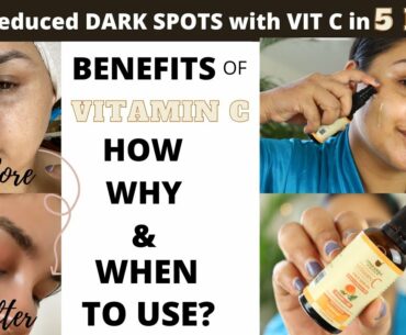 Reducing DARK SPOTS with VITAMIN C SERUM in 5 days | BENEFITS & DEMO||UPAKARMA AYURVEDIC VIT C SERUM