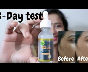 Garnier Light Complete VITAMIN C Booster Face Serum | Spot-Less Skin In Just 3 Days | Review