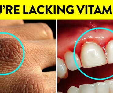 Signs Your Body Is Lacking Vitamin C & Its Benefits