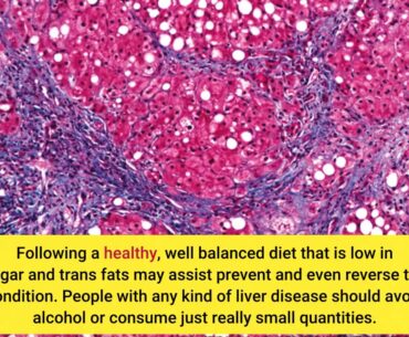 Get This Report about Relation Between Vitamin B12 And Non-alcoholic Fatty Liver