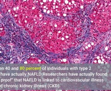 What Does Relation Between Vitamin B12 And Non-alcoholic Fatty Liver Do?