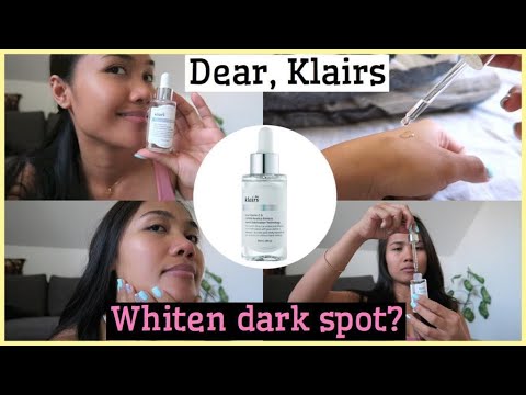 KLAIRS FRESHLY JUICED VITAMIN C SERUM REVIEW | Best Serum for Dark Pimple Marks?