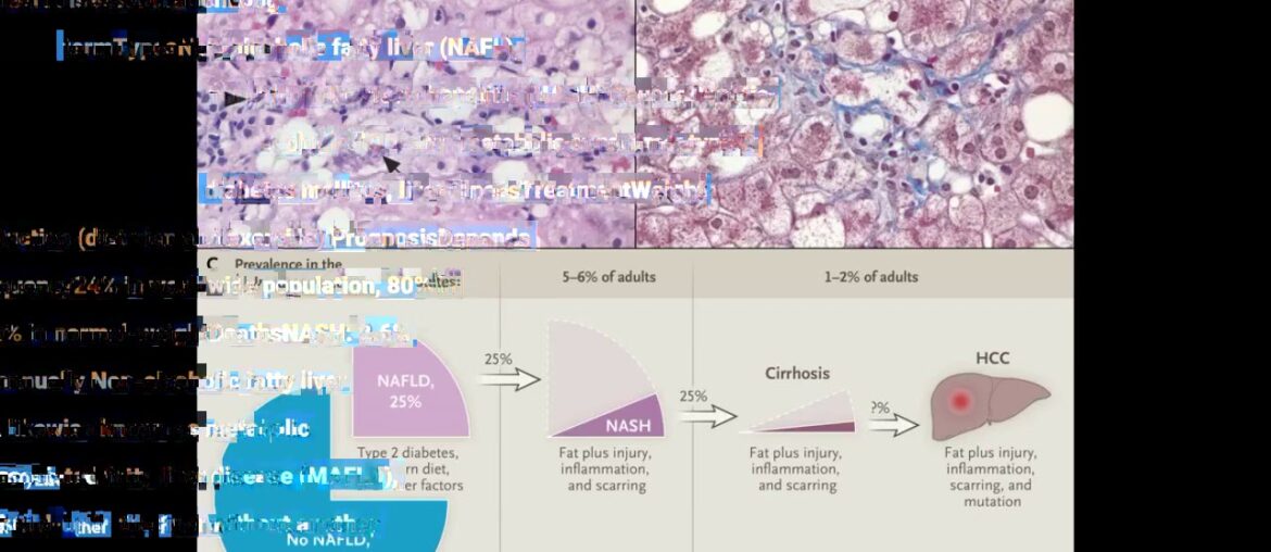 The Basic Principles Of Vitamin D supplementation for nonalcoholic fatty liver disea