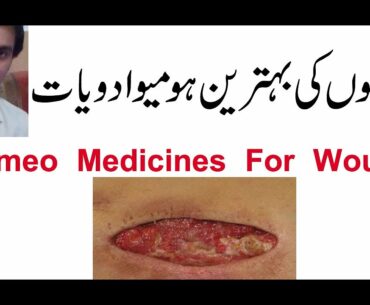 Homeo Medicines For Wounds in urdu in hindi