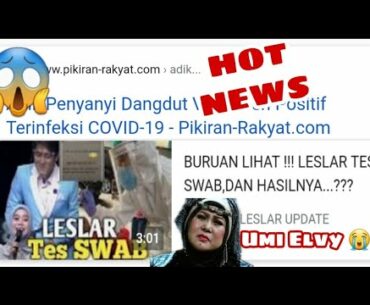 Penyanyi Dangdut Kena C0R0NA | Semoga Dede Lesti Baik-Baik Saja, GWS Umi Elvy