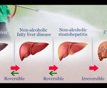 The Definitive Guide to Vitamin E as an Adjuvant Treatment for Non  - Cureus