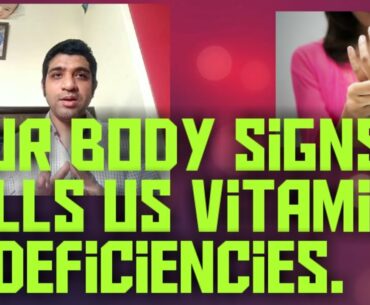 Part 1:Signs your body is deficient in Vitamins. #VitaminAdeficiency #VitaminBdeficiency #VitaminD