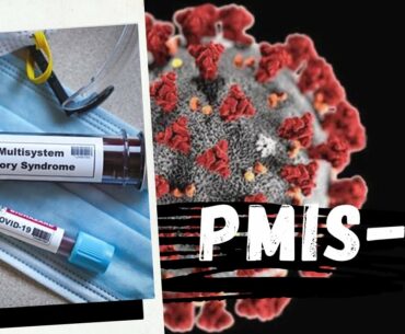 Paediatric Multi System Inflammatory Syndrome in Children ### Temporarily Associated With Covid-19