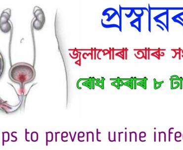 8 tips to prevent urine infection | Urinary Tract Infection | Home Remedies for UTI