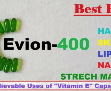 Evion 400 - Vitamin E | Benefits, Sources, Uses | Strech marks remover