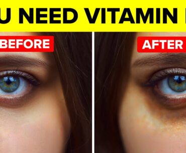 How Vitamin B12 Deficiency Is Hurting Your Health Without You Knowing