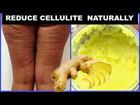 MY AT HOME CELLULITE TREATMENTS | CELLULITE HOME REMEDIES | Khichi Beauty