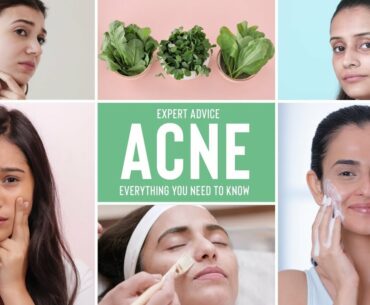 What Is Acne & How To Treat Acne, Acne Scars & Pimples | Expert Advice & Nutrition Tips