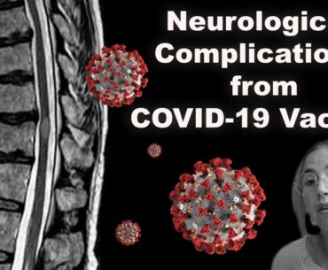 Episode 65: COVID-19 Vaccine | Neurological Complication