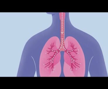 How COVID-19 Affects Your Lungs