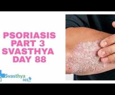 Psoriasis Part 3 I Day-88