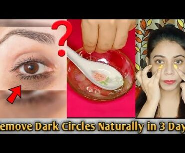 Remove Dark Circles in 3 days with Home Remedy (100% Works) | Makeup Bee