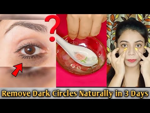 Remove Dark Circles in 3 days with Home Remedy (100% Works) | Makeup Bee