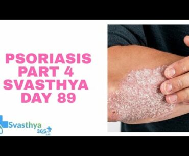 Psoriasis Part 4 I Day-89