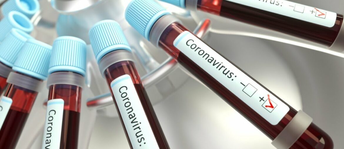 T Cells Play Pivotal Role In Fighting Coronavirus