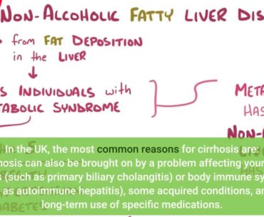 Effect of Vitamin E or Metformin for Treatment of Nonalcoholic Fundamentals Explained